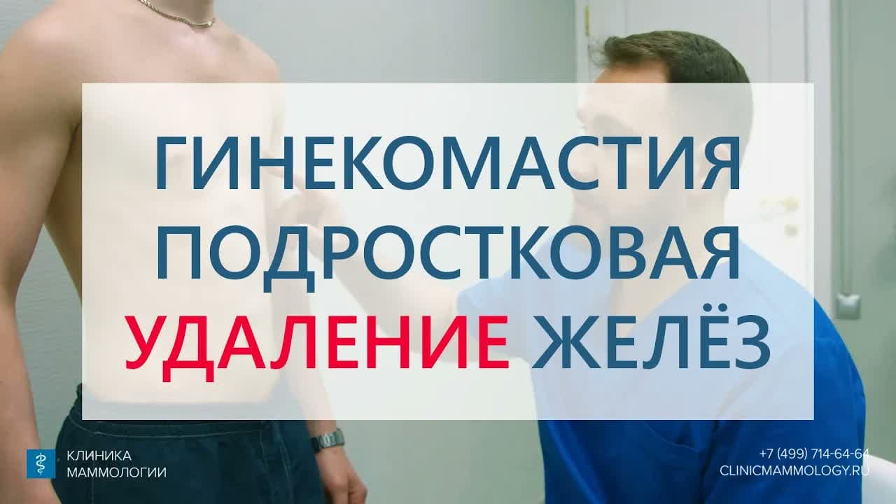 Превью: Гинекомастия 1 тип: удаление молочных желез у подростка