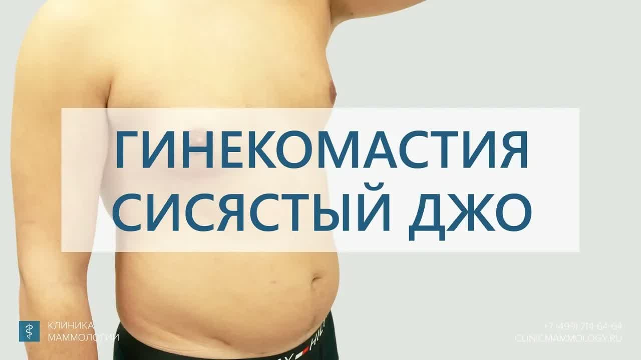Превью: Сисястый Джо: результат лечения гинекомастии