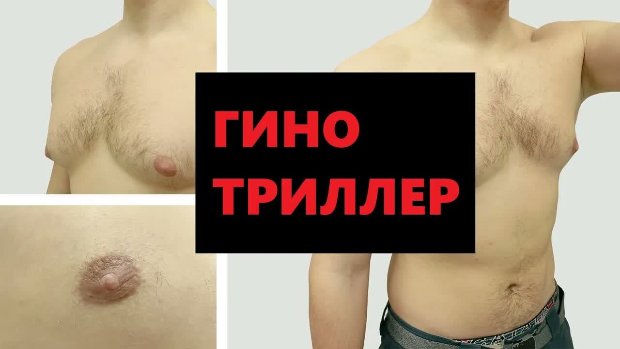 Превью: Гинотриллер: борьба с гинекомастией