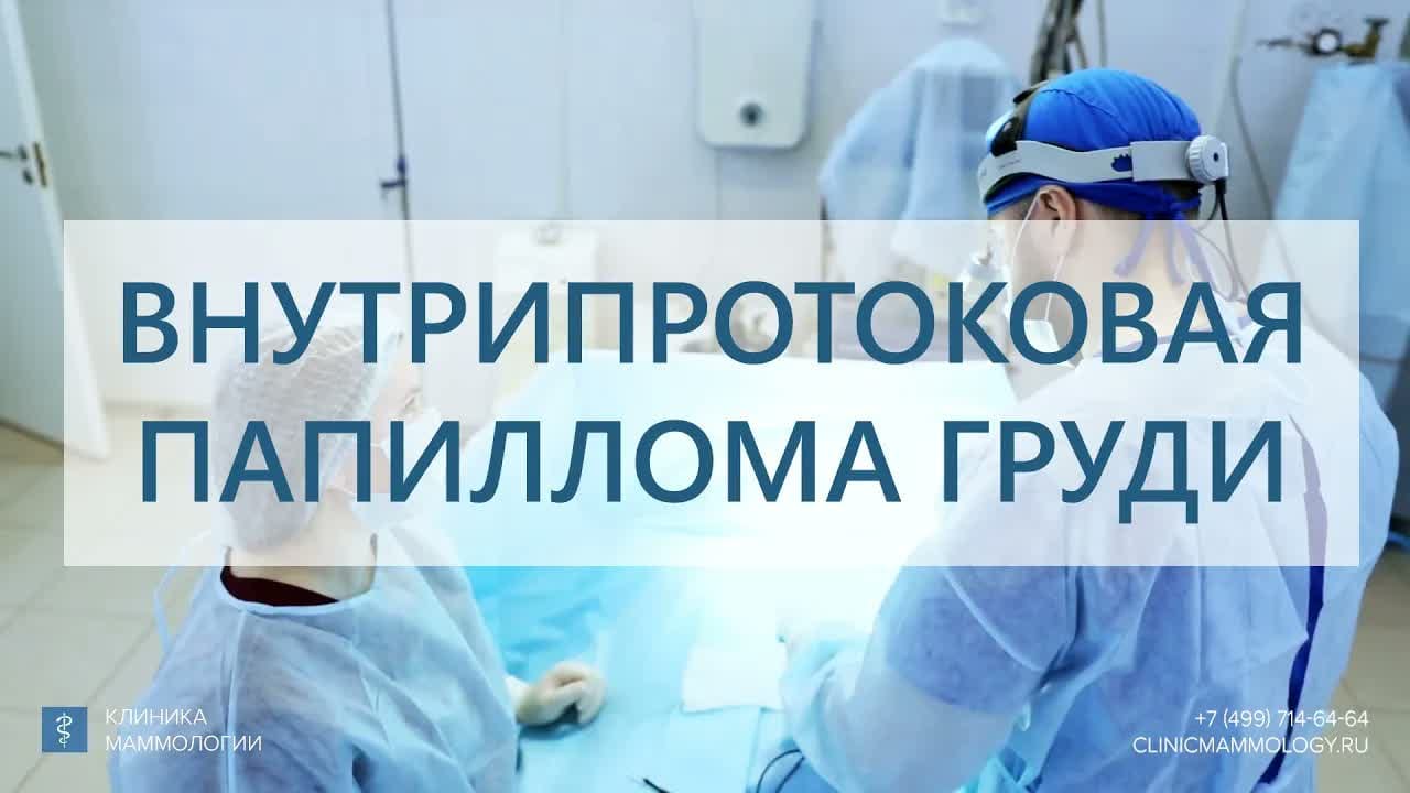 Превью: Внутрипротоковая папиллома: удаление с контрастированием